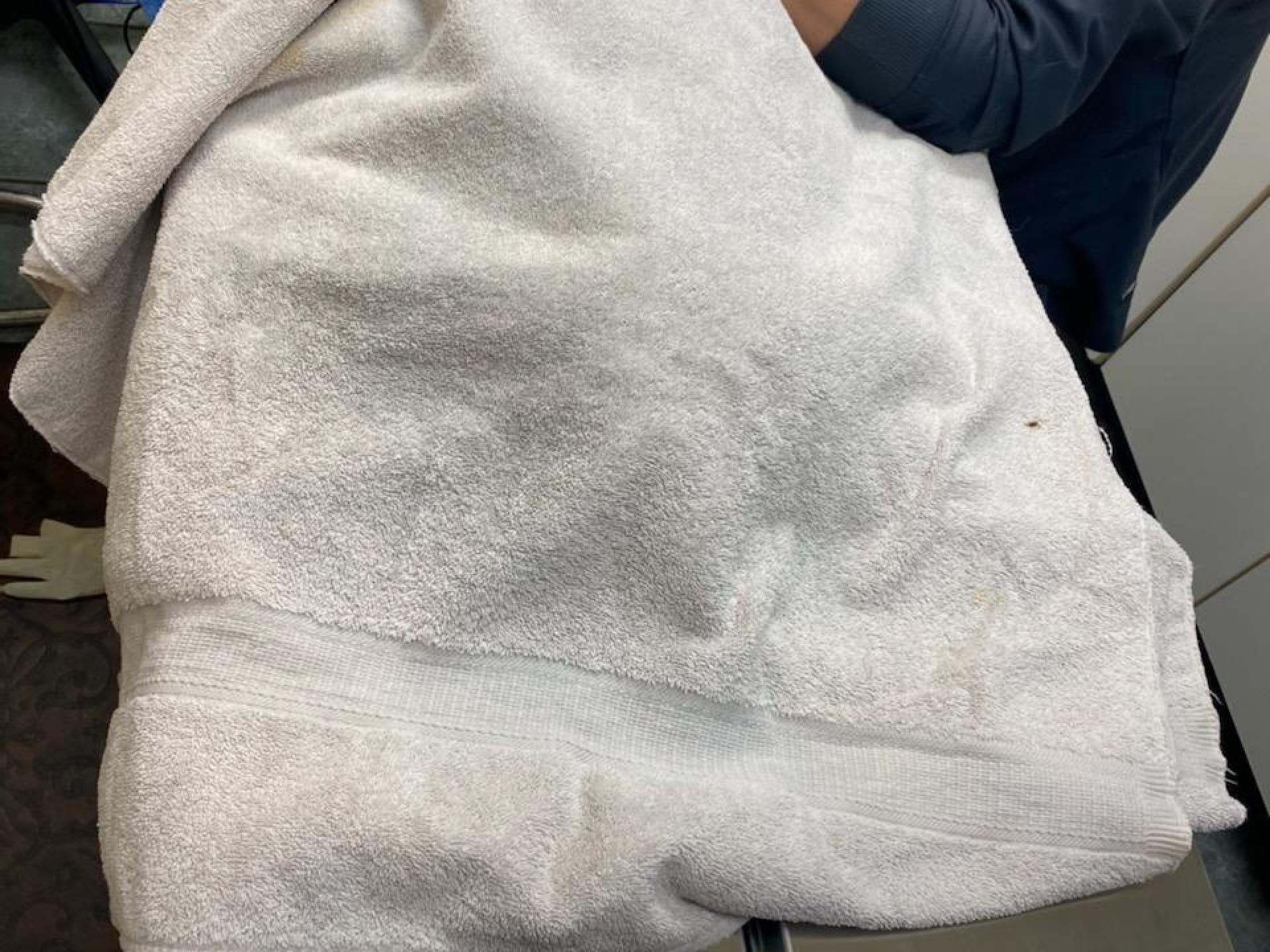 Surgery